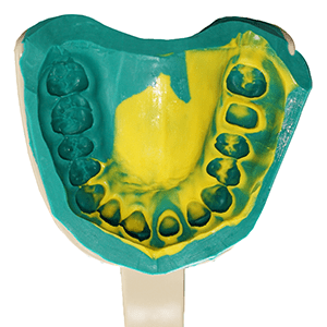 Doric Addition Cured Silicones