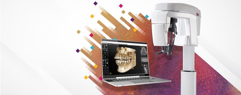 CS 8200 3D CBCT Scanner