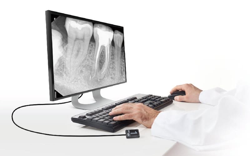 RVG 6200 Intraoral Sensor