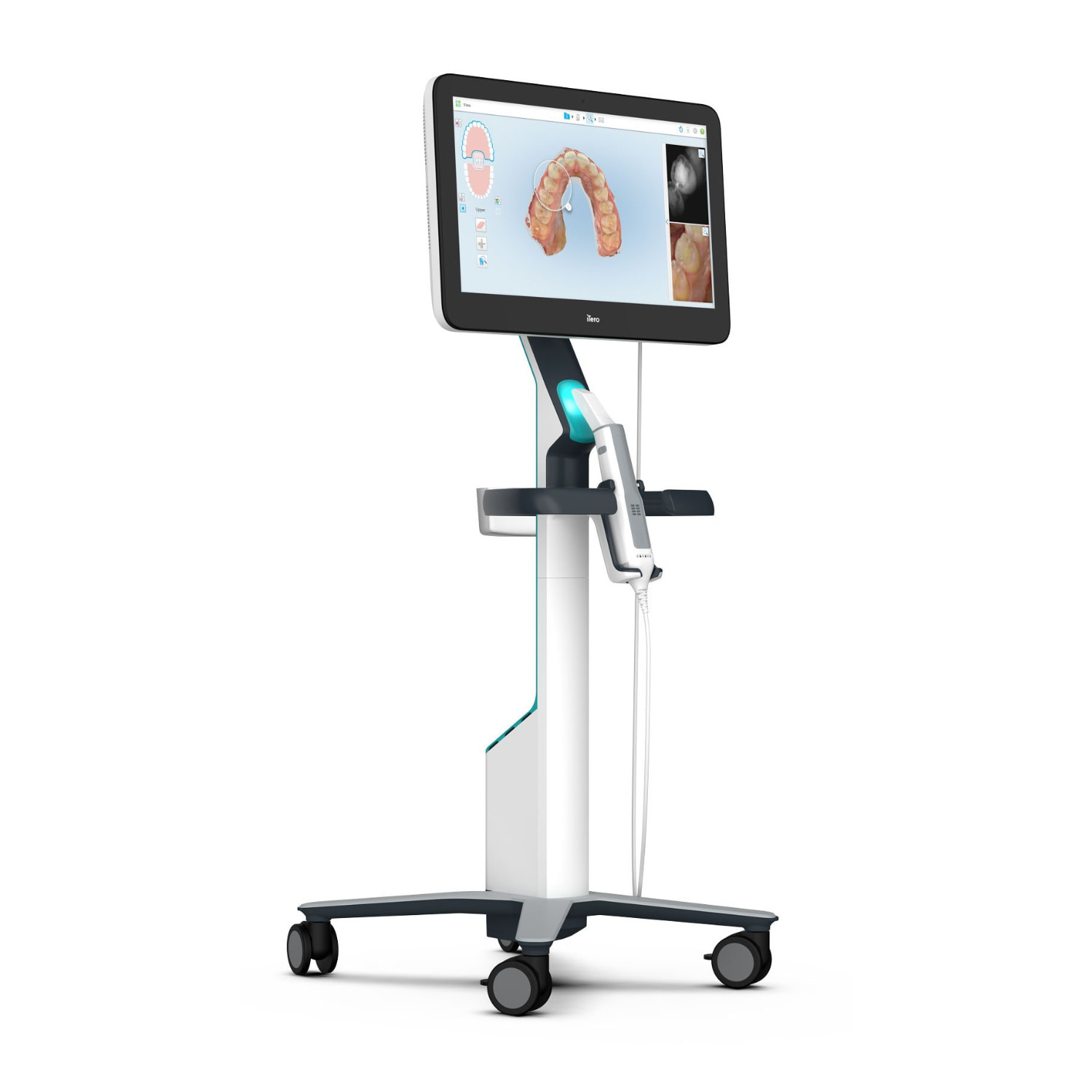 Itero Element 5D Plus Cart Intraoral Scanner