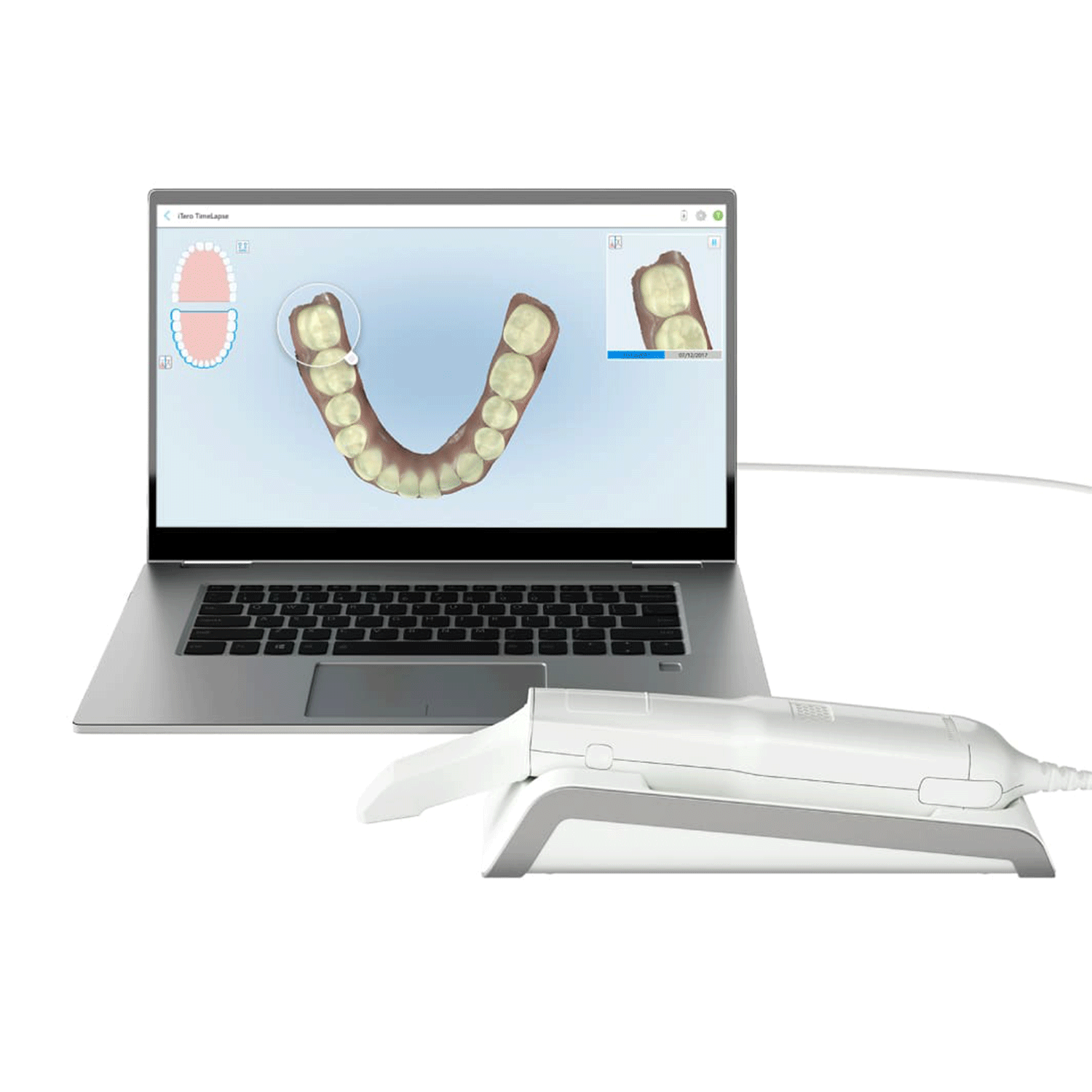 iTero Scanners & Accessories